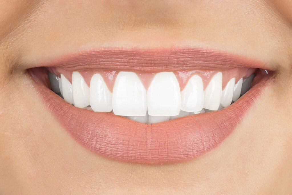 imagem facetas hub odonto