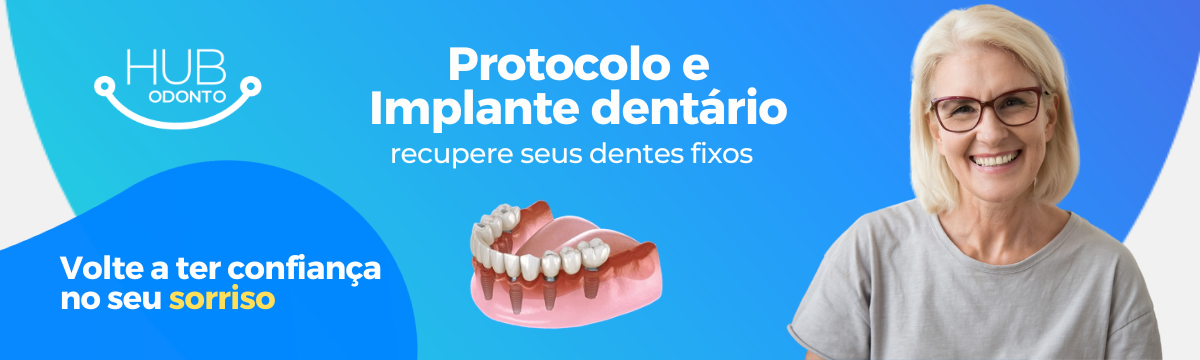 Implantes_hub_odonto